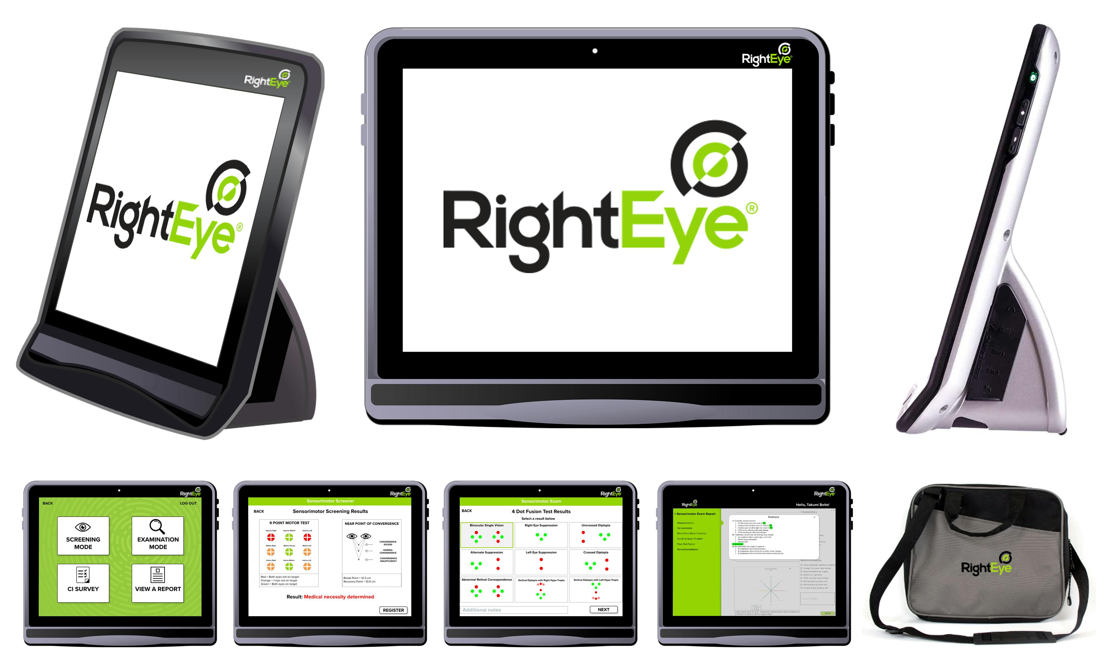 RightEye Launches Automated Sensorimotor Exam for Binocular Vision